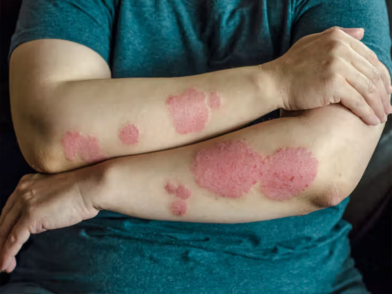 Anagen Boosting Treatment