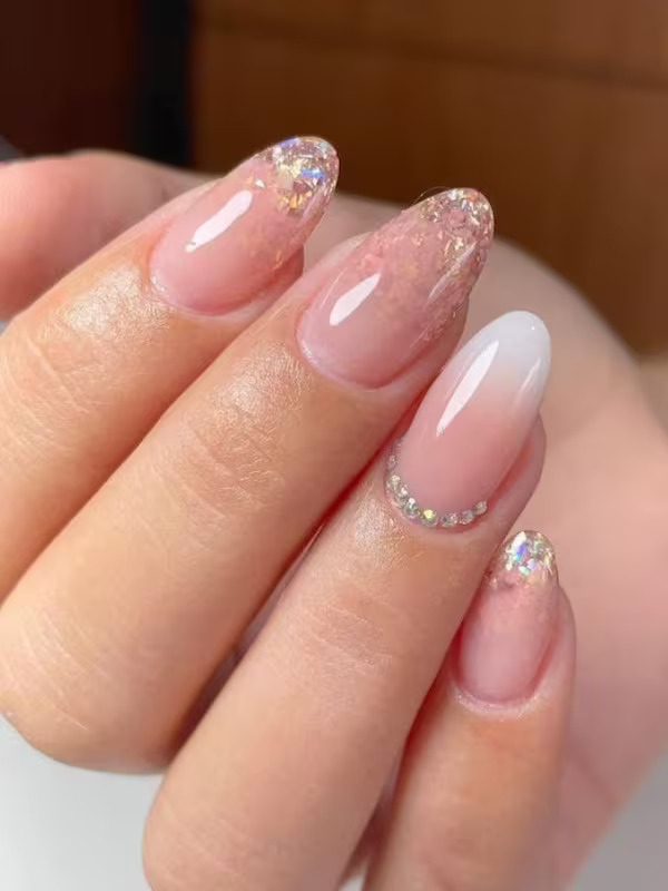 Psoriasis Treatment